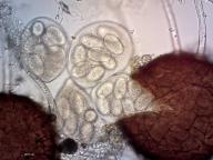 Erysiphe alphitoides 