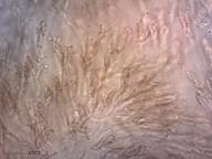 vřecka s výtrusy (H2O)