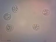 zralé výtrusy (H2O)