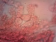 buňky na třeni (kongo červeň NH3)