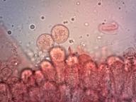 bazidie (kongo červeň NH3)