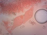 pleurocystidy (kongo červeň NH3) pleurocystidy (kongo červeň NH3)