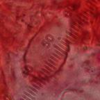 cheilocystida