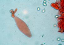 pleurocystida