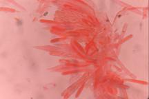 hymenium