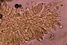 hymenium s bazidiemi a cystidami