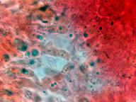 hymenium