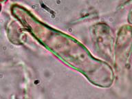 cystida cystida