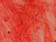 hyfy mycelia s přezkami