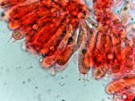 hymenium