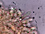 hymenium