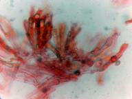 hymenium