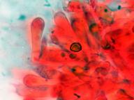 hymenium