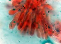hymenium