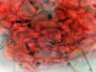 excipulum
