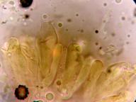hymenium