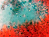 hymenium