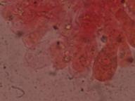 HYMENIUM