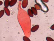 cheilocystida