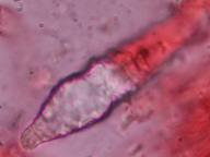 lamprocystida