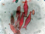 cheilocystidy