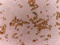 Gymnopilus picreus