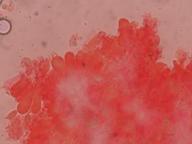 hymenium