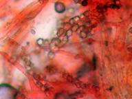 růžicová inkrustace v myceliu růžicová inkrustace v myceliu