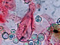cheilocystida