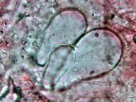 pleurocystidy