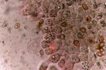 hymenium s cheilocystidou
