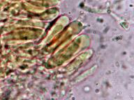 hymenium