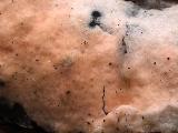 Erythricium laetum