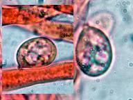Erythricium laetum