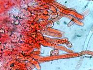 Erythricium laetum