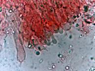 hymenium