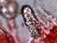 cystida