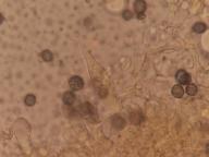 macrocystida