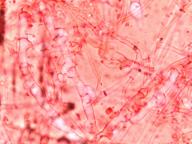 SUBHYMENIUM