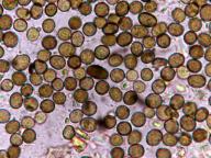 Coniothyrium concentricum