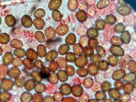 Coniothyrium concentricum