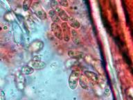 čirůvka masová čirůvka masová