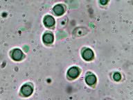 čirůvka oranžová čirůvka oranžová