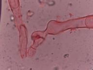 Lamprospora retispora Lamprospora retispora