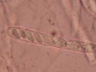 jehnědka zelenavohnědá jehnědka zelenavohnědá