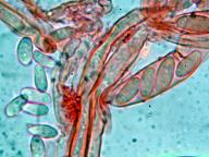 jehnědka zelenavohnědá jehnědka zelenavohnědá