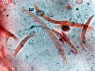 Fusicolla merismoides