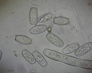 Sarcoscypha austriaca - ohnivec rakouský, spory