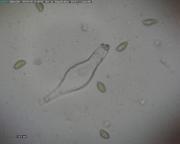 Inocybe whitei - vláknice zardělá, cheilocystidy