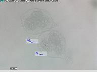 Tuber aestivum